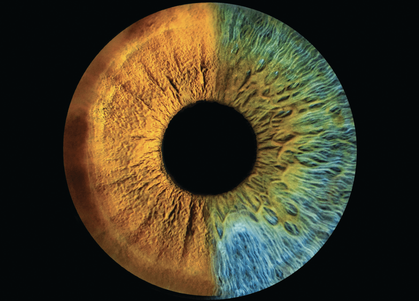 Yeux