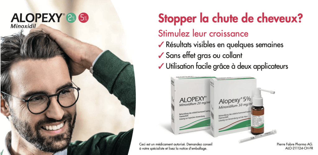 Alopexy