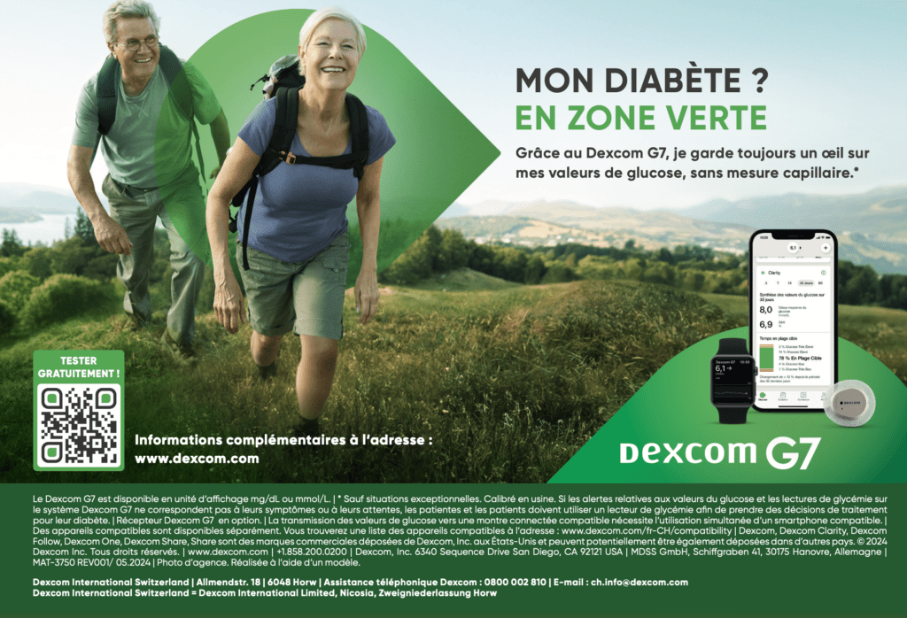 Dexcom G7