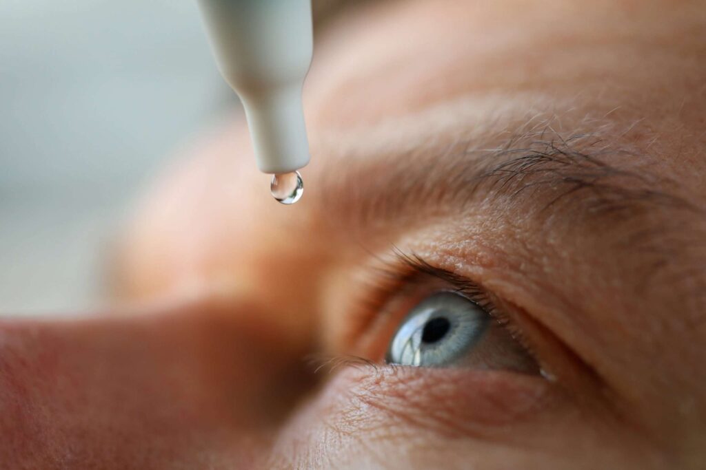 8 remèdes naturels contre les yeux secs
